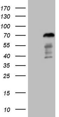 NDUFB11 Antibody
