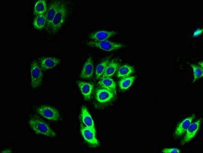 NDUFB11 Antibody