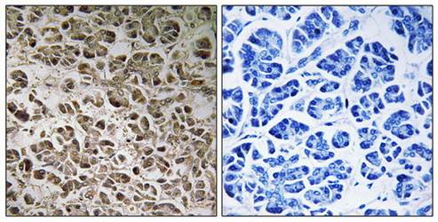 NDUFB1 Antibody