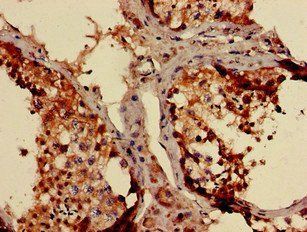 NDUFB3 Antibody