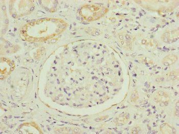 NDUFB5 Antibody