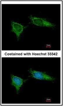 NDUFB5 antibody