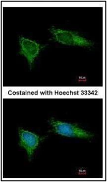 NADH:ubiquinone oxidoreductase subunit B5 Antibody