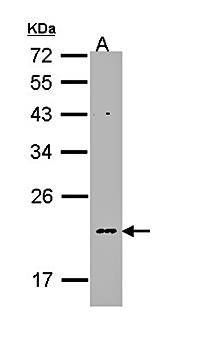 NDUFB5 antibody