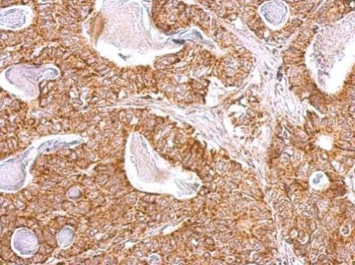 NDUFB9 Rabbit Polyclonal Antibody