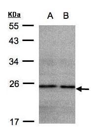 NDUFB9 Rabbit Polyclonal Antibody