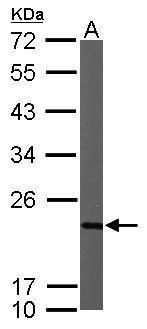 NDUFB9 Rabbit Polyclonal Antibody
