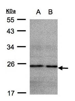 NADH dehydrogenase (ubiquinone) 1 beta subcomplex, 9, 22kDa antibody