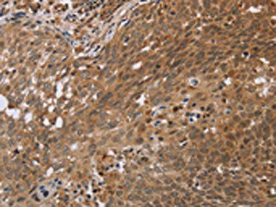 NDUFS2 Antibody