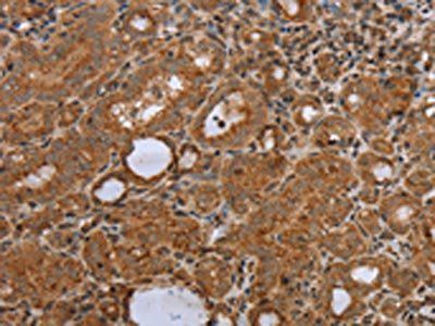 NDUFS2 Antibody