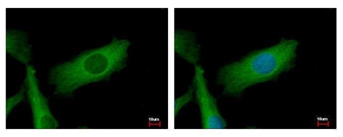 NADH:ubiquinone oxidoreductase core subunit S2 Antibody