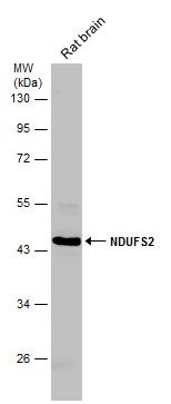 NDUFS2 Rabbit Polyclonal Antibody