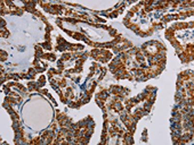 NDUFS3 Antibody