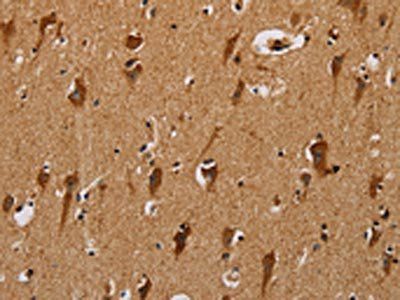NDUFS3 Antibody