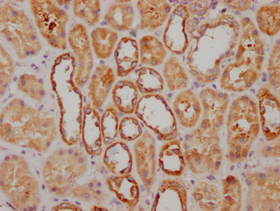 NDUFS3 Recombinant Monoclonal Antibody