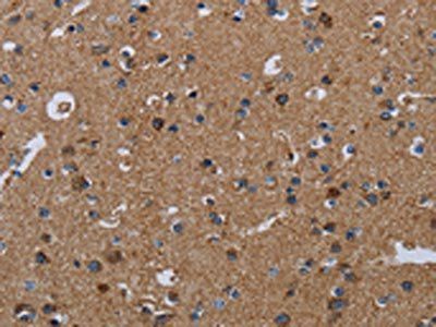 NDUFS4 Antibody