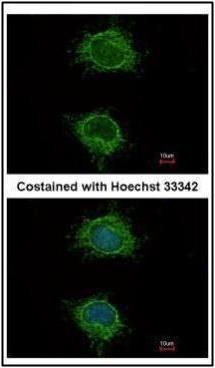 NDUFS4 antibody