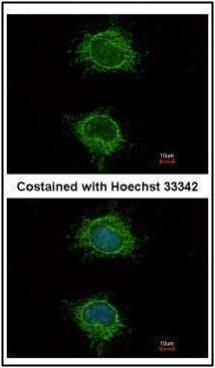 NADH:ubiquinone oxidoreductase subunit S4 Antibody