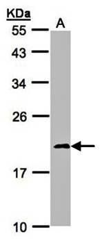 NDUFS4 antibody