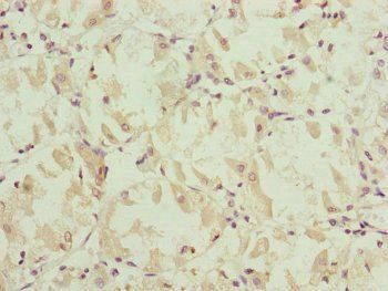 NDUFS6 antibody