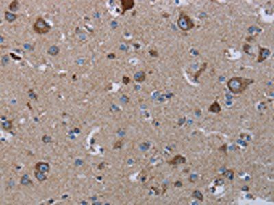 NDUFS8 Antibody