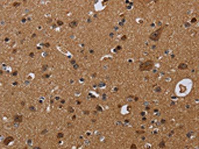 NDUFS8 Antibody