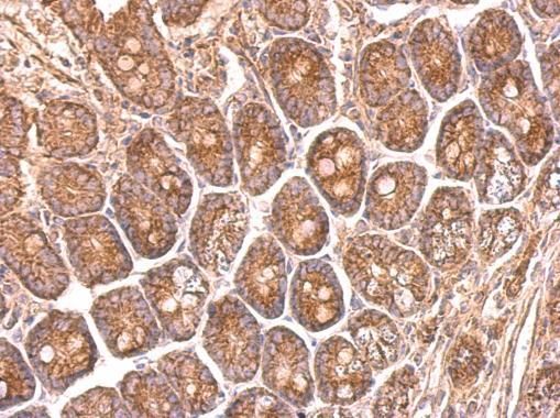 NDUFS8 antibody