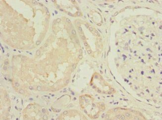 NDUFV1 Antibody