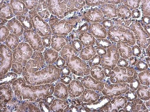 NDUFV1 antibody [N3C3]