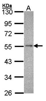 NDUFV1 antibody