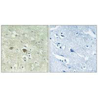 NDUFV3 Antibody