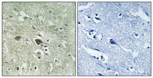 NDUFV3 antibody