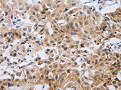 NEB Antibody