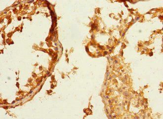 NECTIN3 antibody