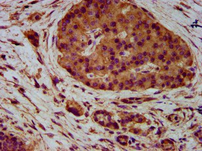 NECTIN4 Antibody