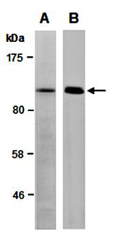 NEDD4 antibody
