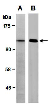 NEDD4 (M) Antibody, Rabbit Polyclonal