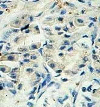 NEDD4 Rabbit Polyclonal Antibody