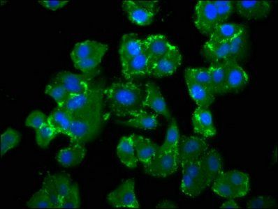 NEDD4L antibody