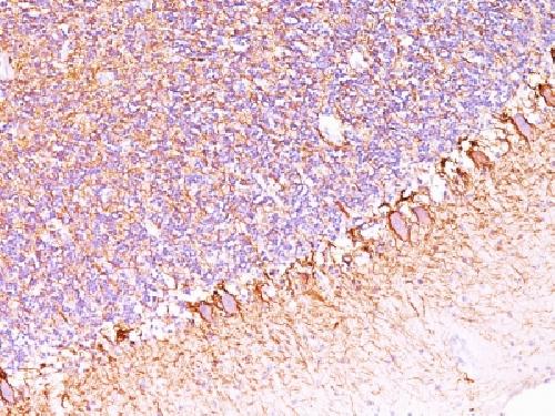 Neurofilament (NF-H) (Neuronal Marker) Antibody