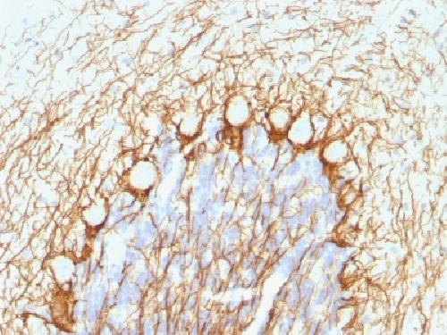 Neurofilament, phospho (NF-H) (Neuronal Marker) Antibody