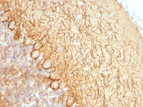 NEFL Antibody