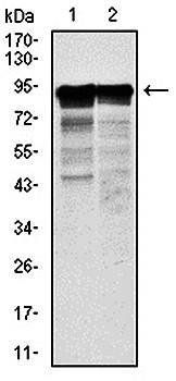 NEFL Antibody