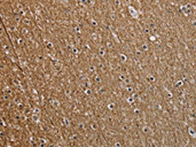 NEFM Antibody