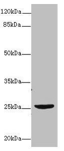 NEGR1 antibody