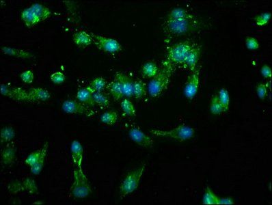 NEK4 Antibody