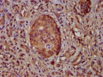 NEK5 Antibody