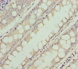 NEK8 Antibody