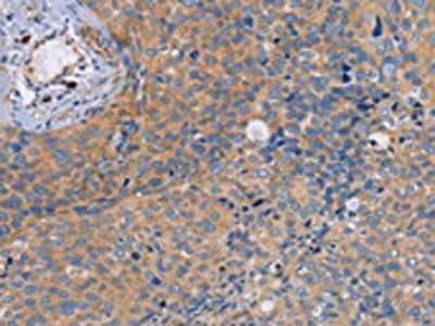 NEK8 Antibody