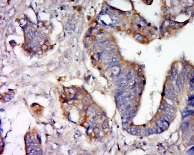 NEK8 Rabbit Polyclonal Antibody